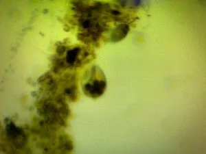 Coral STN Parasite