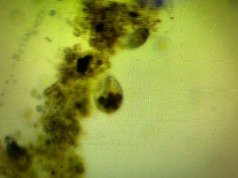 Coral STN Parasite