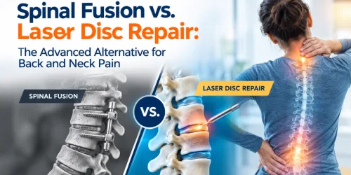 Comparison of spinal fusion vs.