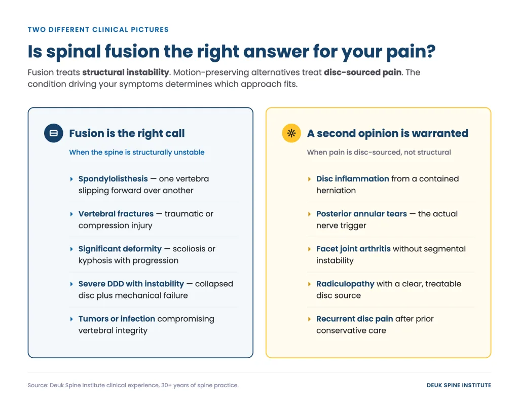 Comparison of spinal fusion and second opinion criteria for treating pain based on structural instability or disc-sourced issues.