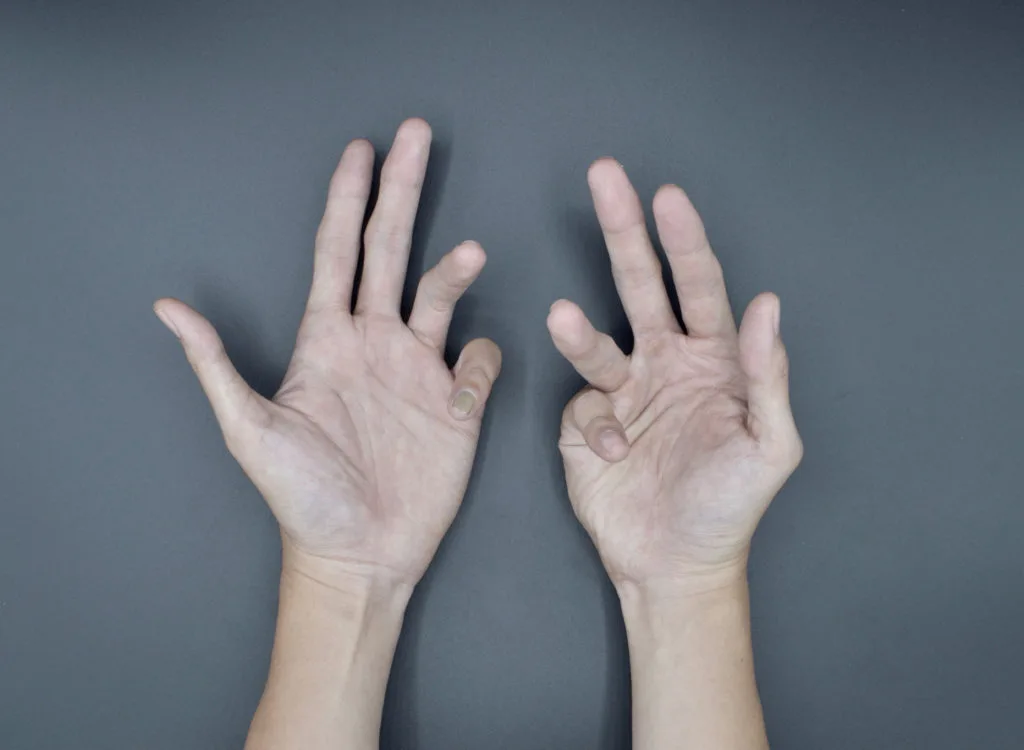 marijuana for spasticity