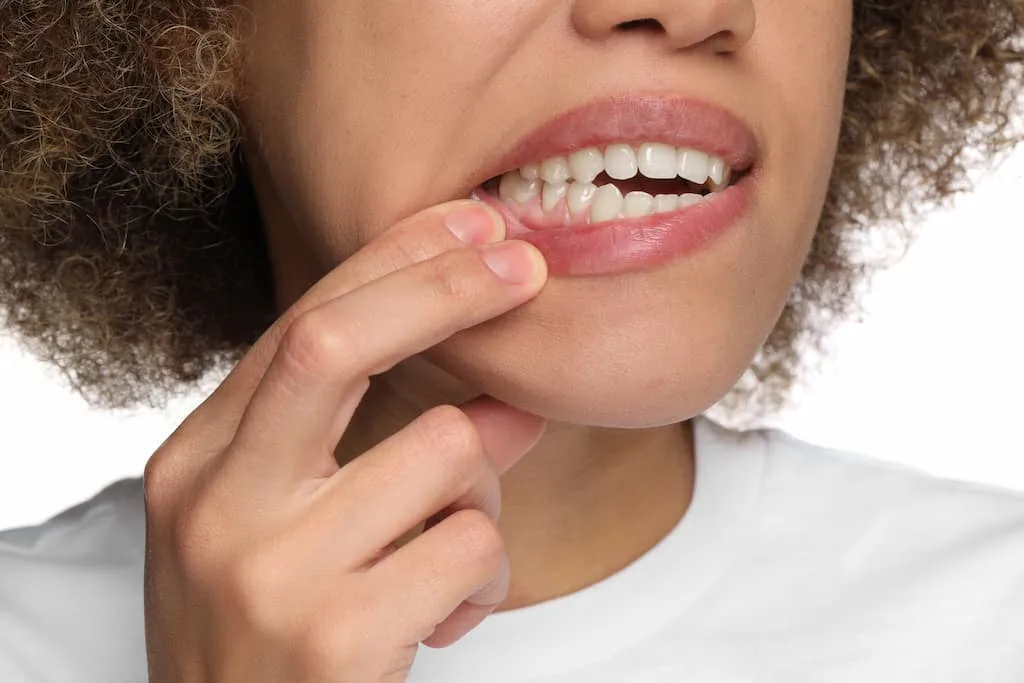 Signs of Gum Disease: Early Warning Symptoms You Shouldn't Ignore