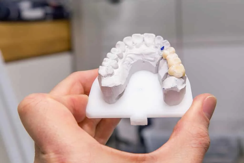 a hand holding a dental mold with a section of teeth.
