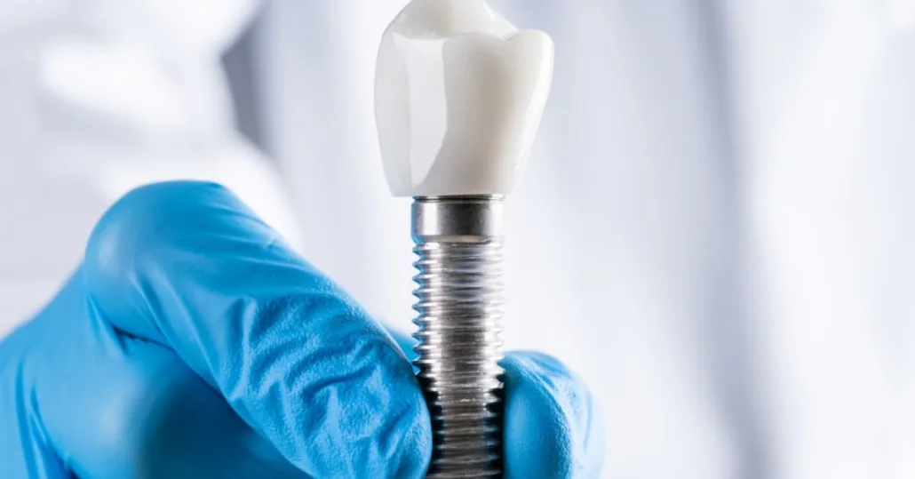 Single-tooth denture CTA