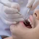all-on-4 vs all-on-6 dental implants: cost, differences & best option 1 all-on-4 vs all-on-6 dental implants