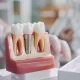 can anyone get dental implants? understanding your candidacy 6 can anyone get dental implants? understanding your candidacy and options