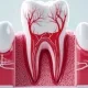 gum disease health effects: how periodontal disease impacts your entire body
