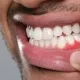 gum disease treatment options: deep cleaning vs. surgery 5 gum disease treatment options