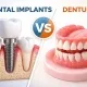 dental implants vs dentures cost, comfort, and long-term value 9 split illustration comparing a dental implant cutaway in the jawbone with a full upper and lower set of dentures