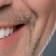 snap-in dentures cost, pros and cons, and how they work 5 snap-in dentures: how implant-supported dentures work