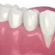 gum recession signs: recognizing the early warnings your mouth is sending 1 gum recession signs: recognizing the early warnings your mouth is sending