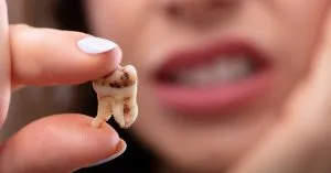 Cavity vs stain diagnosis and treaments