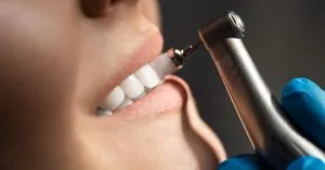 teeth scaling vs cleaning. Understanding your service needs.