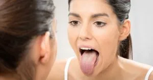 How to treat scalloped tongue
