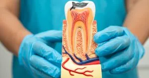 7 root canal symptoms